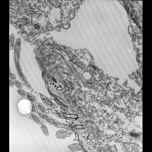  NCBI Organism:Paramecium caudatum; Cell Types:cell by organism, eukaryotic cell, , ; Cell Components:oral apparatus, vesicle membrane, microtubule associated complex, early phagosome; Biological process:oral apparatus organization, digestive system process;