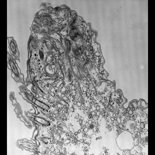  NCBI Organism:Paramecium caudatum; Cell Types:cell by organism, eukaryotic cell, , ; Cell Components:pre-autophagosomal structure Biological process:phagocytosis