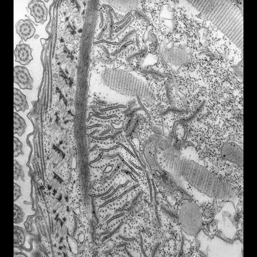  NCBI Organism:Paramecium caudatum; Cell Types:cell by organism, eukaryotic cell, , ; Cell Components:oral apparatus, microtubule associated complex; Biological process:oral apparatus organization, phagocytosis;