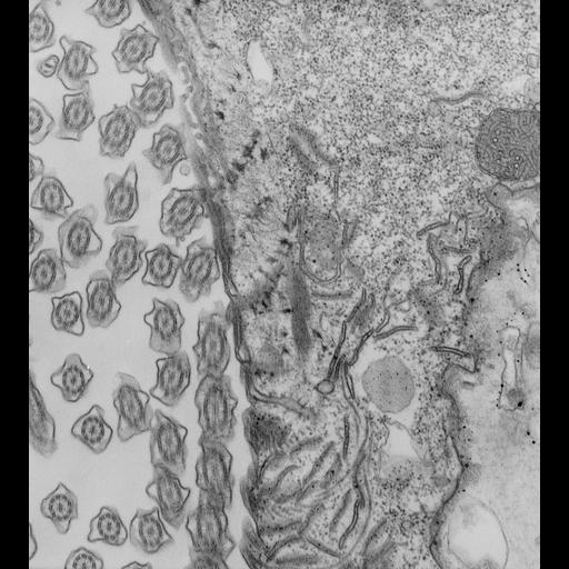  NCBI Organism:Paramecium caudatum; Cell Types:cell by organism, eukaryotic cell, , ; Cell Components:oral apparatus Biological process:oral apparatus organization