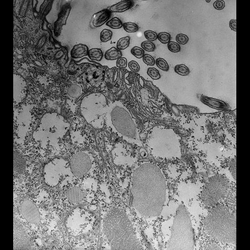  NCBI Organism:Paramecium caudatum; Cell Types:cell by organism, eukaryotic cell, , ; Cell Components:oral apparatus, coated pit, vesicle membrane; Biological process:digestion, digestive system process;