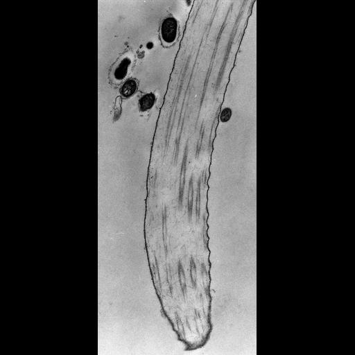  NCBI Organism:Opercularia [NCBITaxon:168247], , ; Cell Types:cell by organism, eukaryotic cell, , ; Cell Components:extracellular region, fibril; Biological process:fibril organization, ;