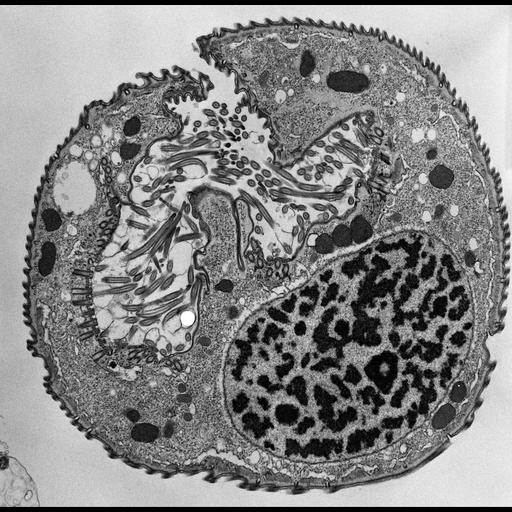  NCBI Organism:Opercularia [NCBITaxon:168247], , ; Cell Types:cell by organism, eukaryotic cell, , ; Cell Components:macronucleus, oral apparatus, mitochondrion, cell cortex, cytoplasm; Biological process:macronucleus organization, cortical cytoskeleton organization, cytoplasm organization, oral apparatus organization;