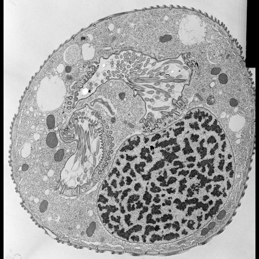  NCBI Organism:Opercularia [NCBITaxon:168247], , ; Cell Types:cell by organism, eukaryotic cell, , ; Cell Components:macronucleus, oral apparatus, mitochondrion, cell cortex, cytoplasm; Biological process:macronucleus organization, cortical cytoskeleton organization, cytoplasm organization, oral apparatus organization, nucleus organization;