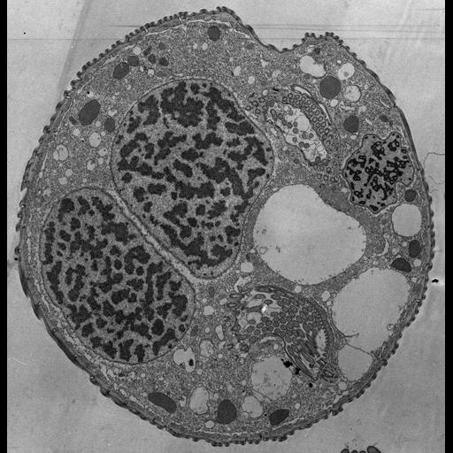  NCBI Organism:Opercularia [NCBITaxon:168247], , ; Cell Types:cell by organism, eukaryotic cell, , ; Cell Components:macronucleus, oral apparatus, mitochondrion, cell cortex, cytoplasm, contractile vacuole, micronucleus; Biological process:macronucleus organization, cortical cytoskeleton organization, cytoplasm organization, contractile vacuole organization, micronucleus organization;