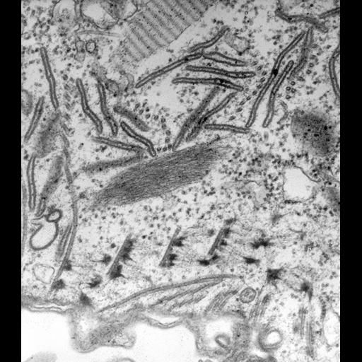  NCBI Organism:Paramecium caudatum; Cell Types:cell by organism, eukaryotic cell, , ; Cell Components:oral apparatus Biological process:oral apparatus organization