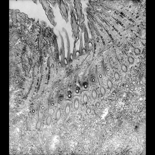  NCBI Organism:Paramecium caudatum; Cell Types:cell by organism, eukaryotic cell, , ; Cell Components:oral apparatus Biological process:oral apparatus organization