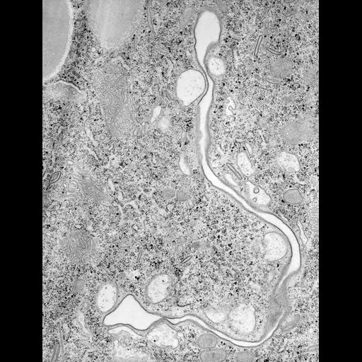  NCBI Organism:Paramecium caudatum; Cell Types:cell by organism, eukaryotic cell, , ; Cell Components:oral apparatus, vacuolar proton-transporting V-type ATPase, V0 domain, ; Biological process:phagocytosis, digestive system process, digestion;