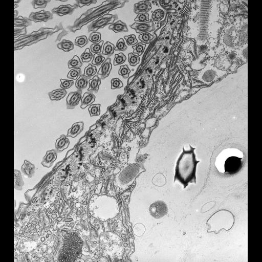  NCBI Organism:Paramecium caudatum; Cell Types:cell by organism, eukaryotic cell, , ; Cell Components:vesicle membrane, endosome; Biological process:phagocytosis