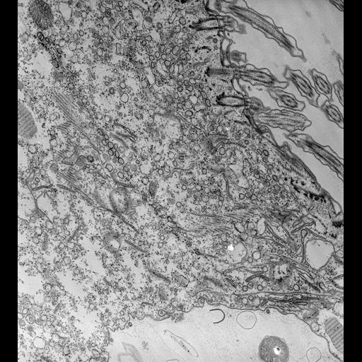  NCBI Organism:Paramecium caudatum; Cell Types:cell by organism, eukaryotic cell, , ; Cell Components:oral apparatus, cytoplasmic microtubule, ; Biological process:oral apparatus organization, phagocytosis;