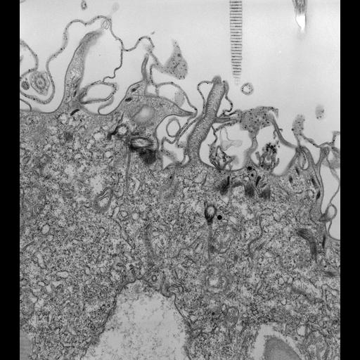  NCBI Organism:Paramecium caudatum; Cell Types:cell by organism, eukaryotic cell, , ; Cell Components:cytoproct, microtubule associated complex, cell cortex, vesicle membrane; Biological process:digestion, digestive system process, cortical cytoskeleton organization;