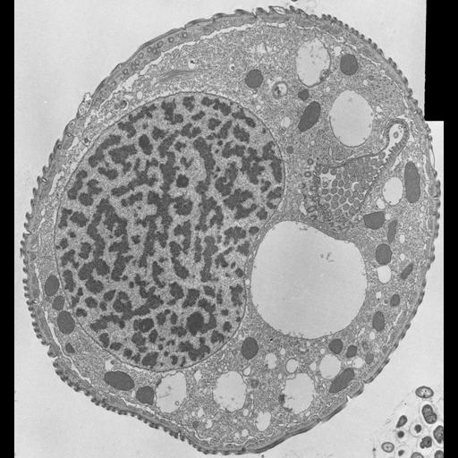  NCBI Organism:Opercularia [NCBITaxon:168247], , ; Cell Types:cell by organism, eukaryotic cell, , ; Cell Components:macronucleus, oral apparatus, mitochondrion, cell cortex, cytoplasm; Biological process:macronucleus organization, cortical cytoskeleton organization, cytoplasm organization;