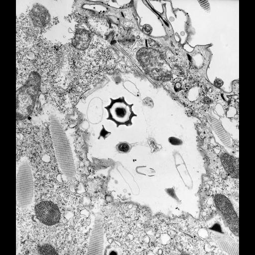  NCBI Organism:Paramecium caudatum; Cell Types:cell by organism, eukaryotic cell, , ; Cell Components:cytoproct, microtubule associated complex, vesicle membrane; Biological process:digestive system process, cortical cytoskeleton organization;