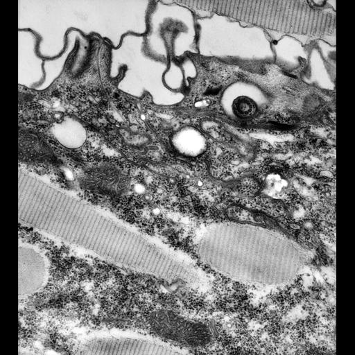  NCBI Organism:Paramecium caudatum; Cell Types:cell by organism, eukaryotic cell, , ; Cell Components:cytoproct, vesicle membrane, microtubule associated complex; Biological process:digestive system process, ;