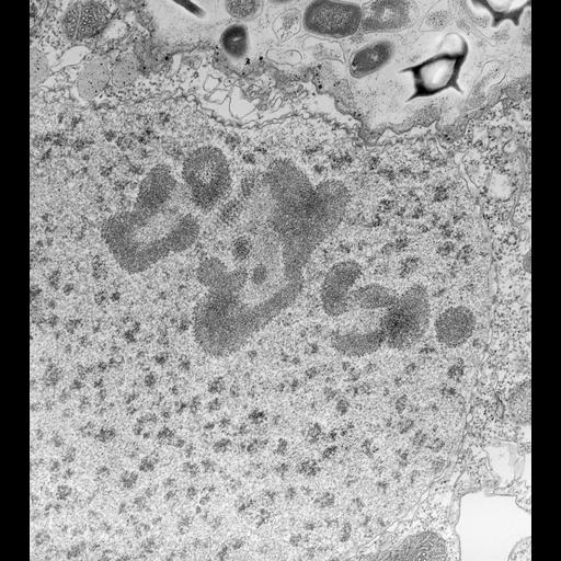  NCBI Organism:Paramecium caudatum; Cell Types:cell by organism, eukaryotic cell, , ; Cell Components:macronucleus, nuclear pore, nucleolus; Biological process:macronucleus organization