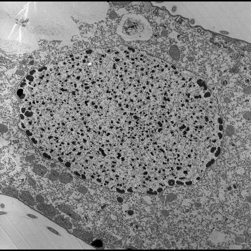  NCBI Organism:Tetrahymena pyriformis; Cell Types:cell by organism, eukaryotic cell, , ; Cell Components:macronucleus, nucleolus; Biological process:macronucleus organization, nucleolus organization;