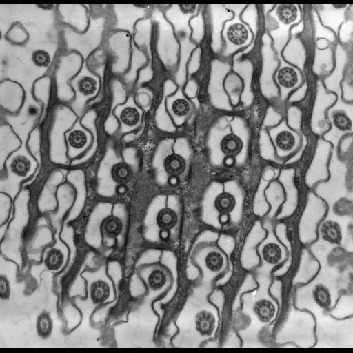  NCBI Organism:uncultured scuticociliate, , ; Cell Types:cell by organism, eukaryotic cell, , ; Cell Components:cell cortex, microtubule basal body, plasma membrane, cortical cytoskeleton, cortical microtubule cytoskeleton, mitochondrion, , cilium axoneme, coated pit; Biological process:cortical cytoskeleton organization, clathrin coat assembly, mitochondrion organization, microtubule basal body organization;