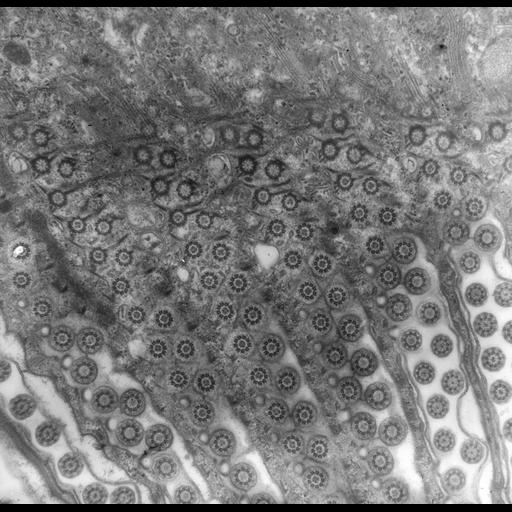  NCBI Organism:uncultured scuticociliate, , ; Cell Types:cell by organism, eukaryotic cell, , ; Cell Components:cell cortex, microtubule basal body, plasma membrane, cortical cytoskeleton, cortical microtubule cytoskeleton, mitochondrion, cilium axoneme, coated pit, oral apparatus; Biological process:cortical cytoskeleton organization, clathrin coat assembly, mitochondrion organization, microtubule basal body organization, oral apparatus organization;