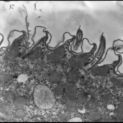  NCBI Organism:uncultured scuticociliate, , ; Cell Types:cell by organism, eukaryotic cell, , ; Cell Components:cell cortex, microtubule basal body, plasma membrane, cortical cytoskeleton, cortical microtubule cytoskeleton, mitochondrion, cilium axoneme, coated pit; Biological process:cortical cytoskeleton organization, clathrin coat assembly, mitochondrion organization, microtubule basal body organization;