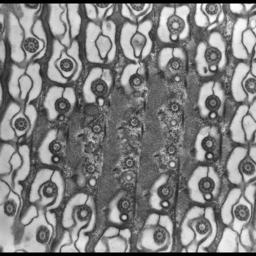  NCBI Organism:uncultured scuticociliate, , ; Cell Types:cell by organism, eukaryotic cell, , ; Cell Components:cell cortex, microtubule basal body, plasma membrane, cortical cytoskeleton, cortical microtubule cytoskeleton, mitochondrion, , cilium axoneme, coated pit; Biological process:cortical cytoskeleton organization, clathrin coat assembly, mitochondrion organization, microtubule basal body organization;