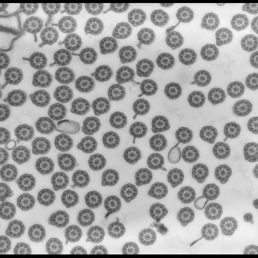  NCBI Organism:uncultured scuticociliate, , ; Cell Types:cell by organism, eukaryotic cell, , ; Cell Components:cilium axoneme, plasma membrane; Biological process:cilium axoneme assembly