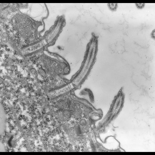  NCBI Organism:uncultured scuticociliate, , ; Cell Types:cell by organism, eukaryotic cell, , ; Cell Components:cell cortex, microtubule basal body, plasma membrane, cortical cytoskeleton, cortical microtubule cytoskeleton, mitochondrion, cilium axoneme, coated pit; Biological process:cortical cytoskeleton organization, clathrin coat assembly, mitochondrion organization, microtubule basal body organization;