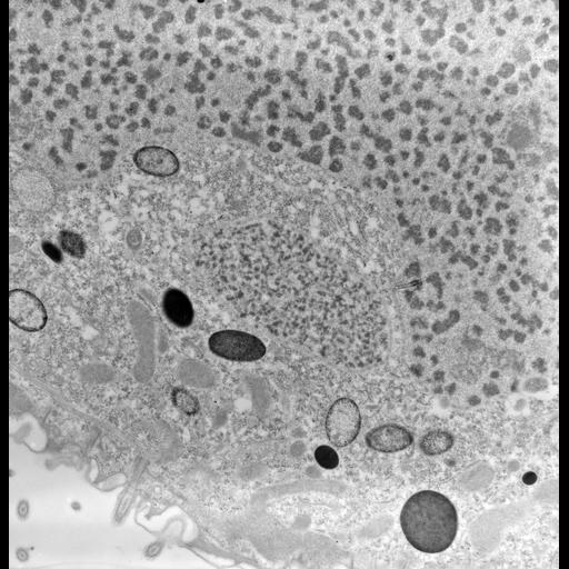  NCBI Organism:uncultured scuticociliate, , ; Cell Types:cell by organism, eukaryotic cell, , ; Cell Components:macronucleus, micronucleus, cytoplasm; Biological process:macronucleus organization, micronucleus organization, cytoplasm organization;