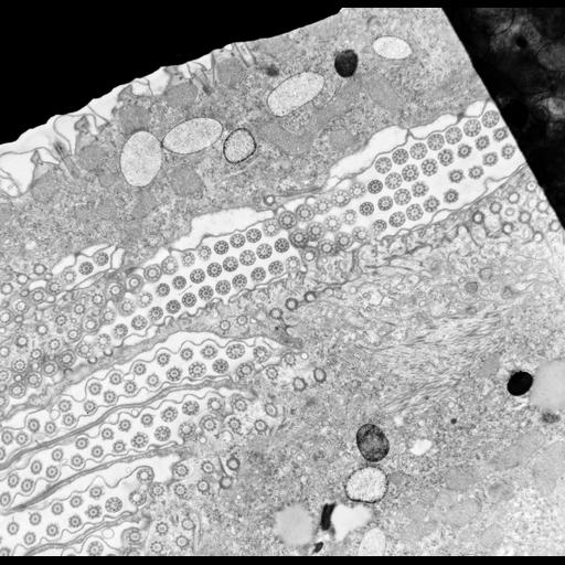  NCBI Organism:uncultured scuticociliate, , ; Cell Types:cell by organism, eukaryotic cell, , ; Cell Components:oral apparatus, plasma membrane, cortical cytoskeleton, cortical microtubule cytoskeleton, mitochondrion, cilium axoneme; Biological process:oral apparatus organization, microtubule basal body organization, cilium axoneme assembly;