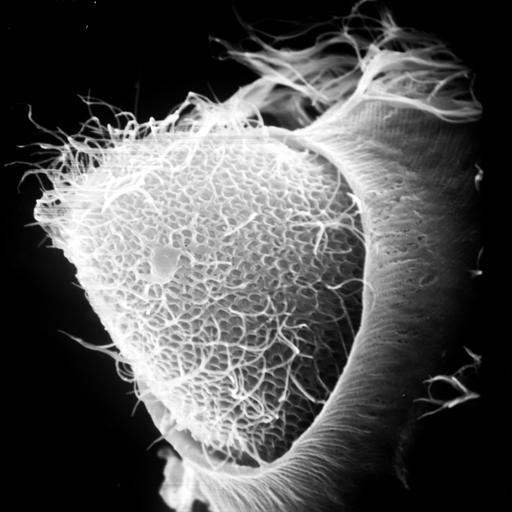  NCBI Organism:Didinium nasutum, Paramecium sp., ; Cell Types:cell by organism, eukaryotic cell, , ; Cell Components:oral apparatus, cell cortex, cell surface; Biological process:phagocytosis, phagocytosis, engulfment;