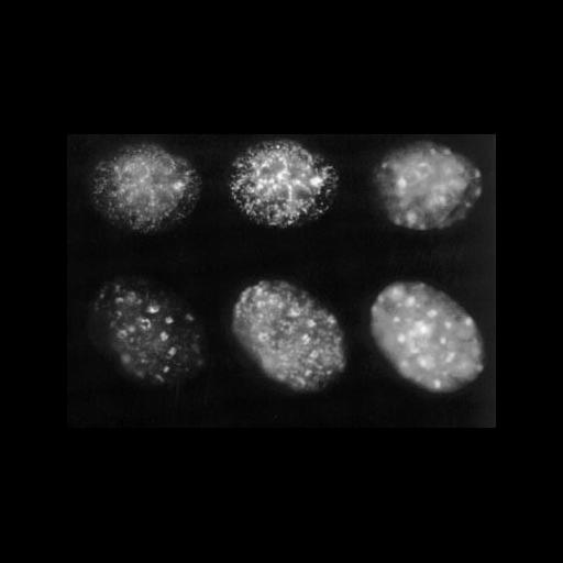  NCBI Organism:Mus musculus; Cell Types:myoblast Cell Components:nuclear chromatin, ; Biological process:DNA replication, DNA metabolic process;