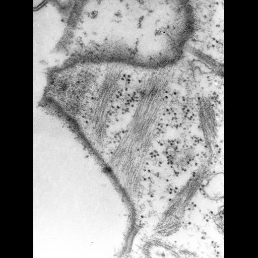  NCBI Organism:Paramecium multimicronucleatum; Cell Types:cell by organism, eukaryotic cell, , ; Cell Components:cell cortex Biological process:cortical cytoskeleton organization