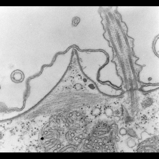  NCBI Organism:Paramecium multimicronucleatum; Cell Types:cell by organism, eukaryotic cell, , ; Cell Components:pellicle, cell cortex; Biological process:plasma membrane organization, cortical cytoskeleton organization;