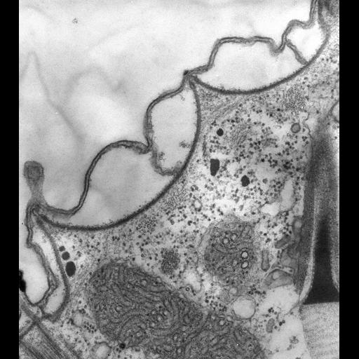  NCBI Organism:Paramecium multimicronucleatum; Cell Types:cell by organism, eukaryotic cell, , ; Cell Components:pellicle, cell cortex; Biological process:plasma membrane organization, cortical cytoskeleton organization;