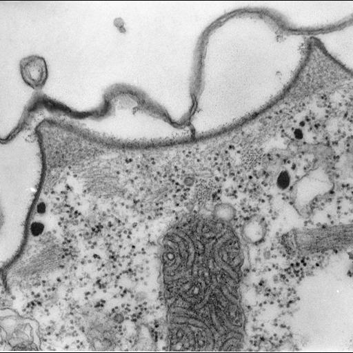  NCBI Organism:Paramecium multimicronucleatum; Cell Types:cell by organism, eukaryotic cell, , ; Cell Components:pellicle, cell cortex; Biological process:plasma membrane organization, cortical cytoskeleton organization;