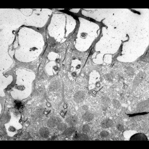  NCBI Organism:Paramecium multimicronucleatum; Cell Types:cell by organism, eukaryotic cell, , ; Cell Components:cell cortex, microtubule basal body, microtubule associated complex; Biological process:cortical cytoskeleton organization