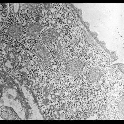  NCBI Organism:Vorticella convallaria; Cell Types:cell by organism, eukaryotic cell, , ; Cell Components:rough endoplasmic reticulum, lysosome, Golgi apparatus, cytoplasm, ; Biological process:Golgi organization, cytoplasm organization;