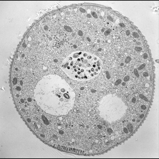 CIL:39327, Vorticella convallaria, cell by organism, eukaryotic cell ...