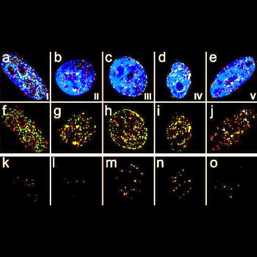  NCBI Organism:Homo sapiens; Cell Types:epithelial cell Cell Components:nucleus, condensed nuclear chromosome, centromeric region; Biological process:DNA metabolic process, DNA replication;