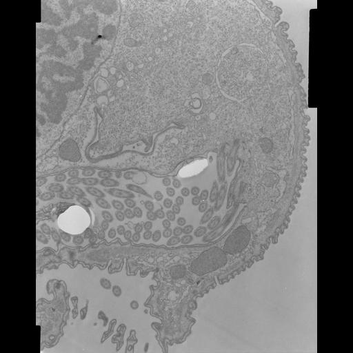  NCBI Organism:Opercularia [NCBITaxon:168247], , ; Cell Types:cell by organism, eukaryotic cell, , ; Cell Components:macronucleus, oral apparatus, contractile vacuole, cell cortex, cytoplasm; Biological process:macronucleus organization, cortical cytoskeleton organization, cytoplasm organization, contractile vacuole discharge;