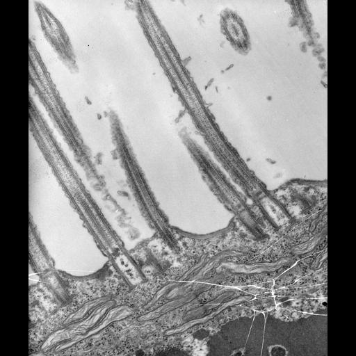  NCBI Organism:Euplotes sp.; Cell Types:cell by organism, eukaryotic cell, , ; Cell Components:cilium, cilium axoneme, microtubule basal body; Biological process:ciliary or flagellar motility, microtubule basal body organization, cytoplasm organization;