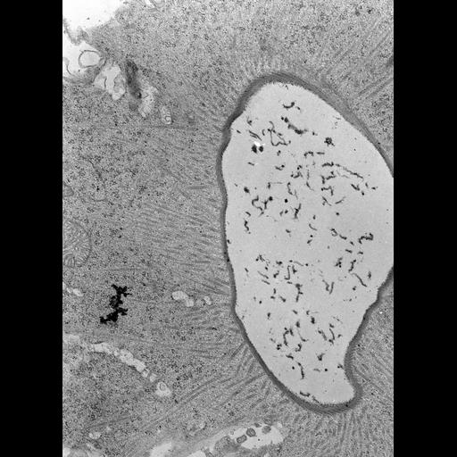  NCBI Organism:Nassula; Cell Types:cell by organism, eukaryotic cell, , ; Cell Components:contractile vacuole pore, microtubule associated complex, cytoplasm; Biological process:, microtubule cytoskeleton organization, cytoplasm organization;