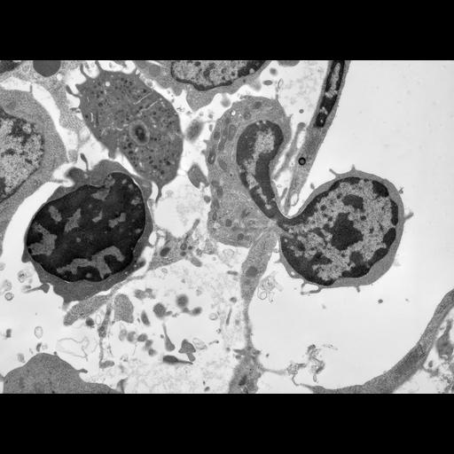  Cell Types:endothelial cell, blood cell; Cell Components:nucleus, cell surface; Biological process:cellular extravasation