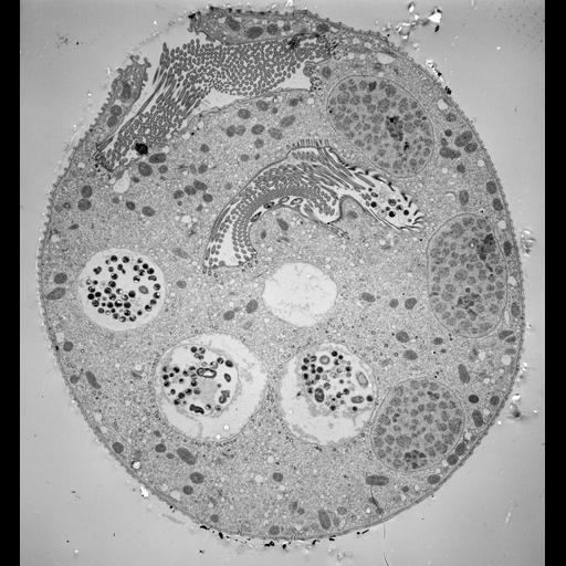  NCBI Organism:Vorticella convallaria; Cell Types:cell by organism, eukaryotic cell, , ; Cell Components:cell, food vacuole, macronucleus, oral apparatus, cytostome; Biological process:digestive system process, cytoplasm organization, cortical cytoskeleton organization, macronucleus organization, oral apparatus organization, digestive system process;