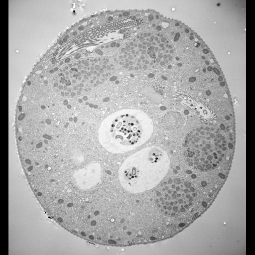  NCBI Organism:Vorticella convallaria; Cell Types:cell by organism, eukaryotic cell, , ; Cell Components:cell, food vacuole; Biological process:digestive system process, cytoplasm organization, cortical cytoskeleton organization;