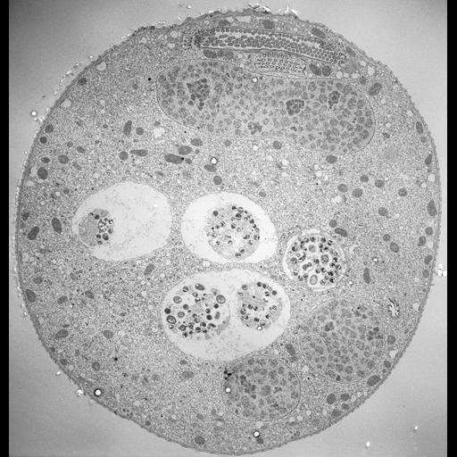  NCBI Organism:Vorticella convallaria; Cell Types:cell by organism, eukaryotic cell, , ; Cell Components:cell, food vacuole, macronucleus, oral apparatus, ; Biological process:digestive system process, cytoplasm organization, cortical cytoskeleton organization, macronucleus organization, oral apparatus organization, digestive system process;