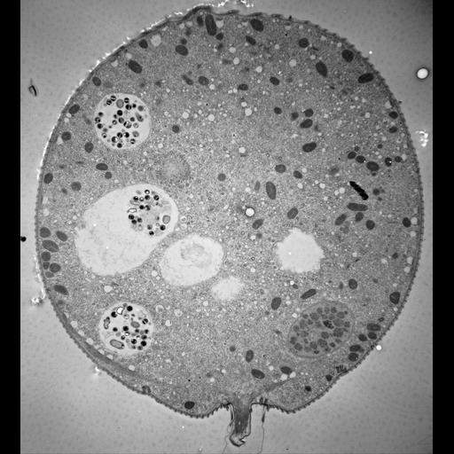  NCBI Organism:Vorticella convallaria; Cell Types:cell by organism, eukaryotic cell, , ; Cell Components:cell, food vacuole, macronucleus, ; Biological process:digestive system process, cytoplasm organization, cortical cytoskeleton organization, macronucleus organization, ;