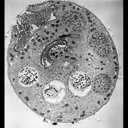  NCBI Organism:Vorticella convallaria; Cell Types:cell by organism, eukaryotic cell, , ; Cell Components:cell, food vacuole, macronucleus, oral apparatus; Biological process:digestive system process, cytoplasm organization, cortical cytoskeleton organization, macronucleus organization, oral apparatus organization;