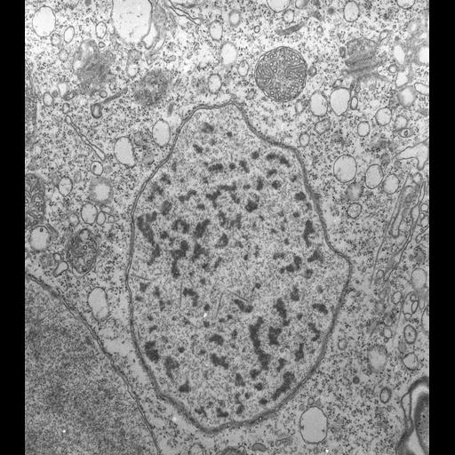  NCBI Organism:Vorticella convallaria; Cell Types:cell by organism, eukaryotic cell, , ; Cell Components:micronucleus, macronucleus, nuclear pore, heterochromatin; Biological process:micronucleus organization, macronucleus organization;