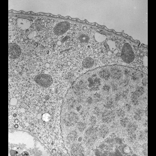  NCBI Organism:Vorticella convallaria; Cell Types:cell by organism, eukaryotic cell, , ; Cell Components:macronucleus, nucleolus, microtubule associated complex, phagocytic cup, phagocytic vesicle membrane, ; Biological process:macronucleus organization, digestive system process;