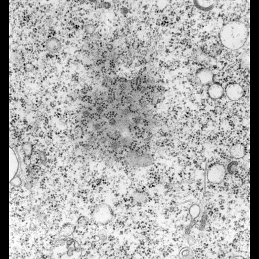  NCBI Organism:Vorticella convallaria; Cell Types:cell by organism, eukaryotic cell, , ; Cell Components:nuclear envelope, polysome, nuclear pore; Biological process:nucleus organization, ;